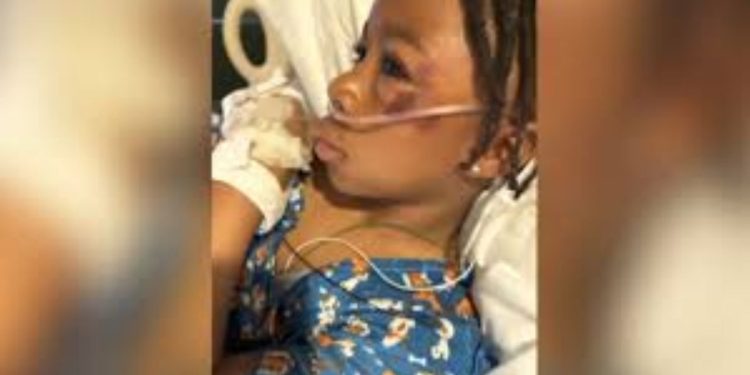 9-year-old seriously injured in DC hit-and-run