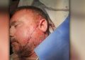 Man Gets More Than 50 Stitches After Being Slashed By Stranger Outside Tufts Medical Center