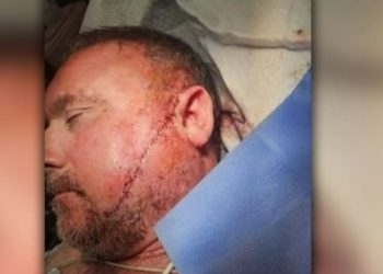Man Gets More Than 50 Stitches After Being Slashed By Stranger Outside Tufts Medical Center