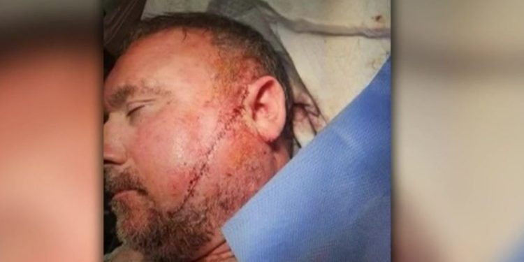 Man Gets More Than 50 Stitches After Being Slashed By Stranger Outside Tufts Medical Center